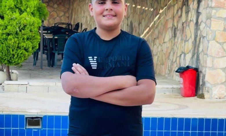 الجلزون