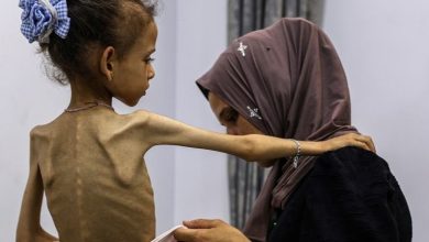 المجاعة قطاع غزة